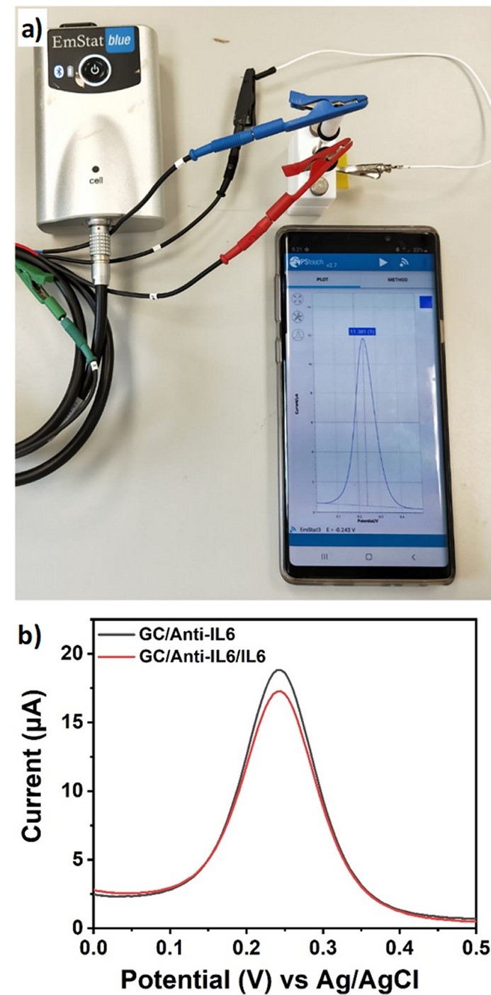 Development Of Graphene Biosensors For IL 6 Indication In Disease